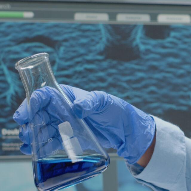 Laboratory scientist analyzing chemical glass beaker with liquid at scientific research clinic. Doctor using biology equipment and glassware studying solution and blood for development